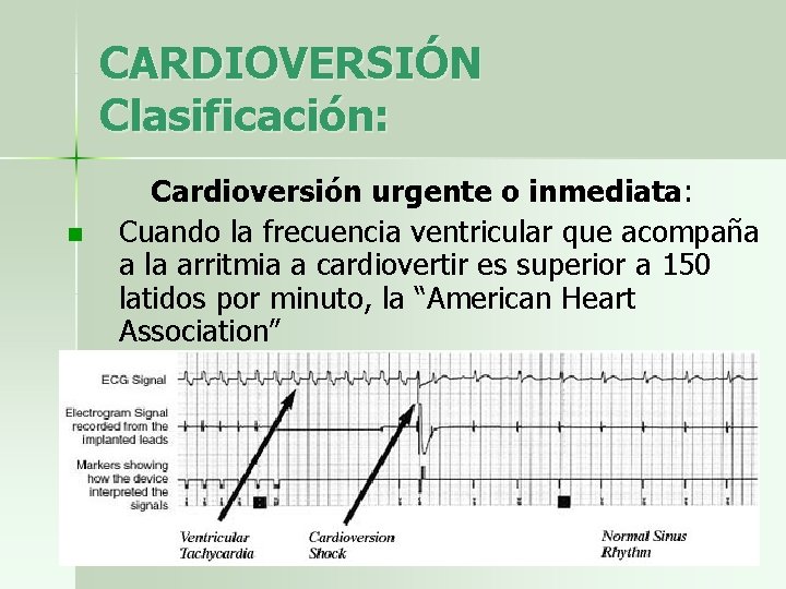 CARDIOVERSIÓN Clasificación: n Cardioversión urgente o inmediata: Cuando la frecuencia ventricular que acompaña a