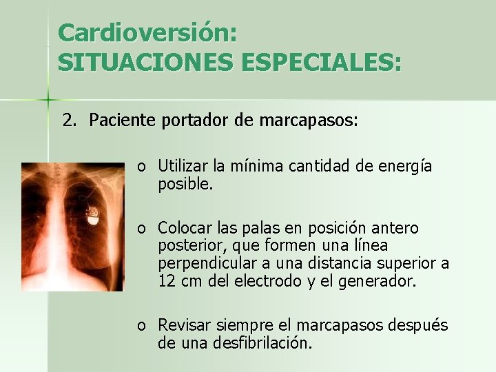 Cardioversión: SITUACIONES ESPECIALES: 2. Paciente portador de marcapasos: o Utilizar la mínima cantidad de