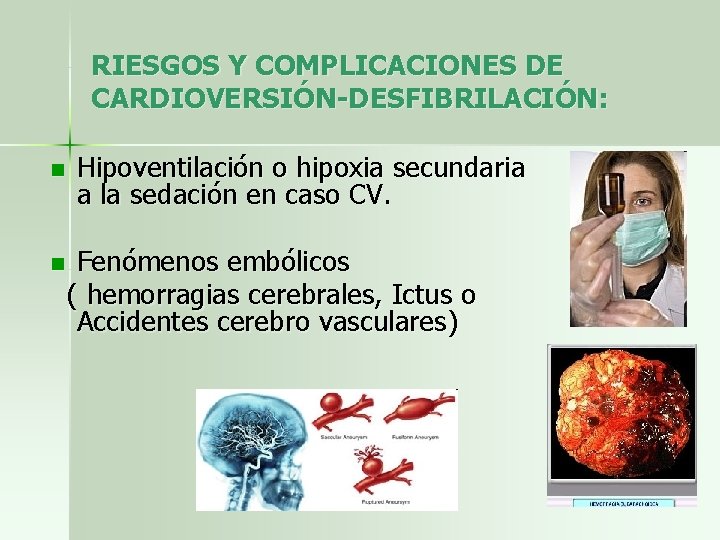 RIESGOS Y COMPLICACIONES DE CARDIOVERSIÓN-DESFIBRILACIÓN: n Hipoventilación o hipoxia secundaria a la sedación en