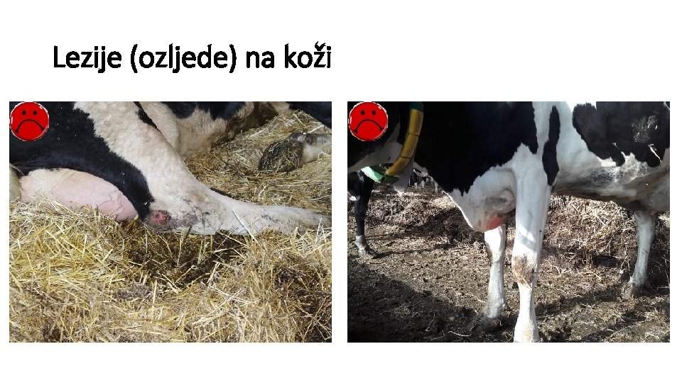 Lezije (ozljede) na koži 