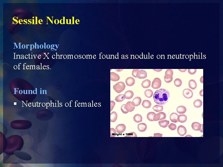 Sessile Nodule Morphology Inactive X chromosome found as nodule on neutrophils of females. Found