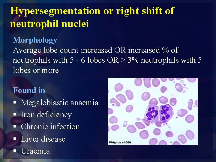 Hypersegmentation or right shift of neutrophil nuclei Morphology Average lobe count increased OR increased