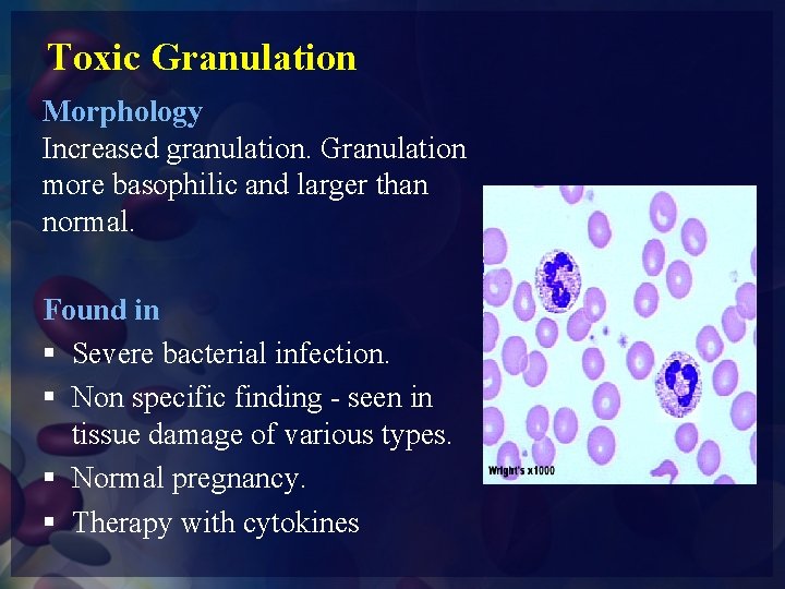 Toxic Granulation Morphology Increased granulation. Granulation more basophilic and larger than normal. Found in