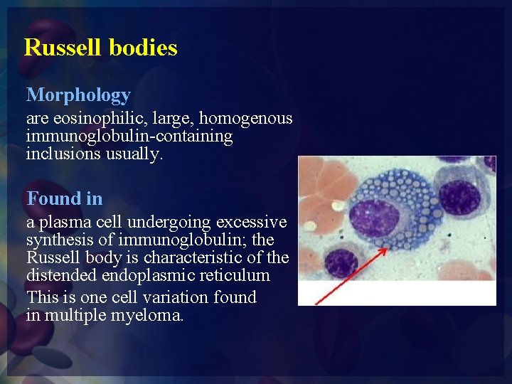 Russell bodies Morphology are eosinophilic, large, homogenous immunoglobulin-containing inclusions usually. Found in a plasma