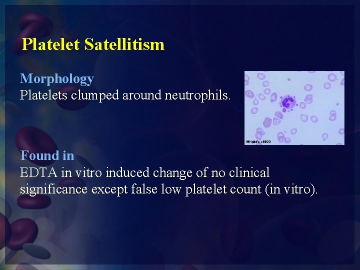 Platelet Satellitism Morphology Platelets clumped around neutrophils. Found in EDTA in vitro induced change