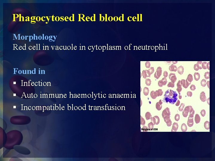 Phagocytosed Red blood cell Morphology Red cell in vacuole in cytoplasm of neutrophil Found