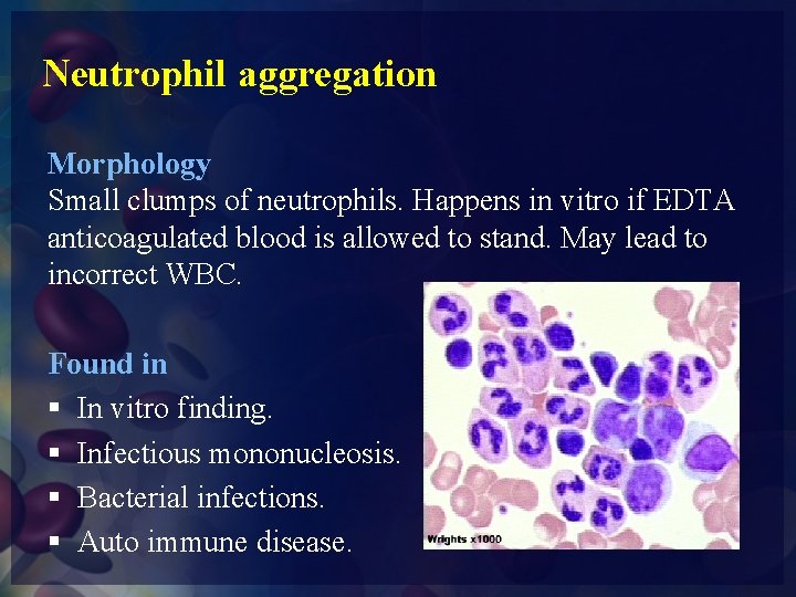 Neutrophil aggregation Morphology Small clumps of neutrophils. Happens in vitro if EDTA anticoagulated blood