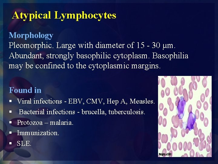 Atypical Lymphocytes Morphology Pleomorphic. Large with diameter of 15 - 30 µm. Abundant, strongly