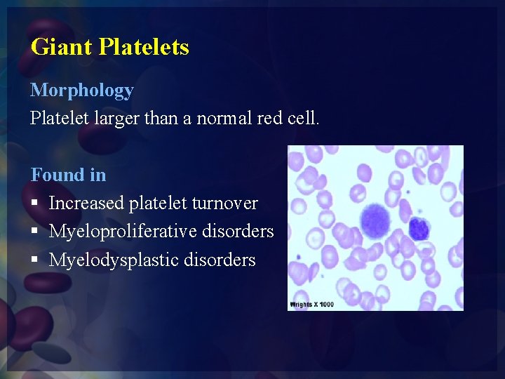 Giant Platelets Morphology Platelet larger than a normal red cell. Found in § Increased