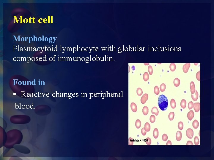 Mott cell Morphology Plasmacytoid lymphocyte with globular inclusions composed of immunoglobulin. Found in §