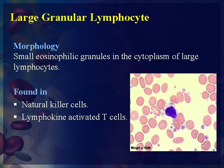 Large Granular Lymphocyte Morphology Small eosinophilic granules in the cytoplasm of large lymphocytes. Found