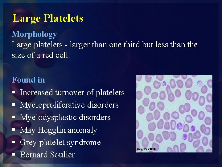 Large Platelets Morphology Large platelets - larger than one third but less than the