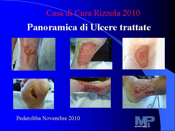 Casa di Cura Rizzola 2010 Panoramica di Ulcere trattate Pederobba Novembre 2010 