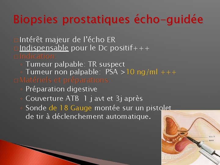 Biopsies prostatiques écho-guidée � Intérêt majeur de l’écho ER � Indispensable pour le Dc