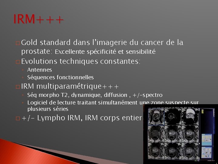 IRM+++ � Gold standard dans l’imagerie du cancer de la prostate: Excellente spécificité et