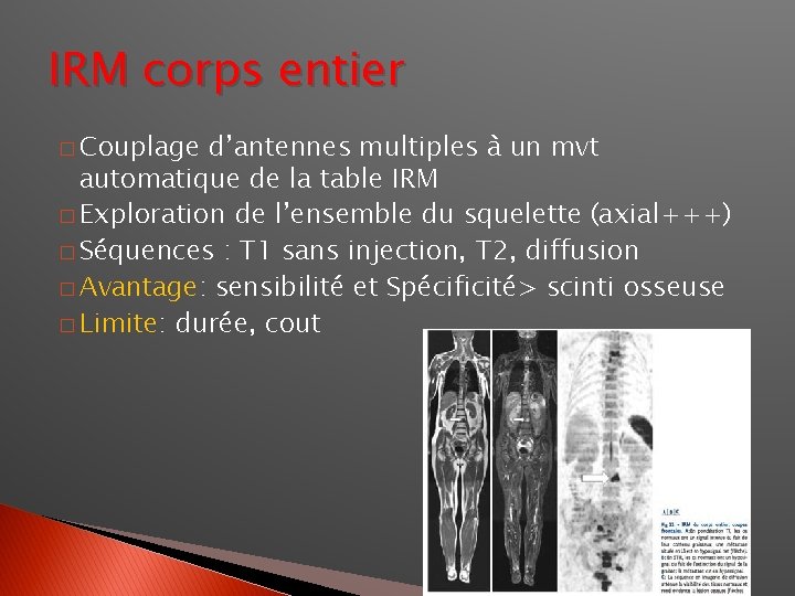 IRM corps entier � Couplage d’antennes multiples à un mvt automatique de la table