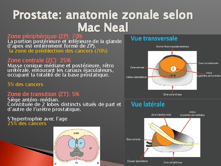 Prostate: anatomie zonale selon Mac Neal Zone périphérique (ZP): 70% La portion postérieure et