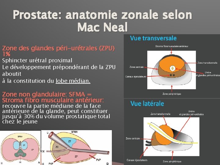 Prostate: anatomie zonale selon Mac Neal Zone des glandes péri-urétrales (ZPU) 1% Sphincter urétral