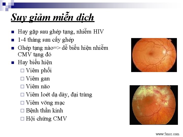 Suy giảm miễn dịch n n Hay gặp sau ghép tạng, nhiễm HIV 1