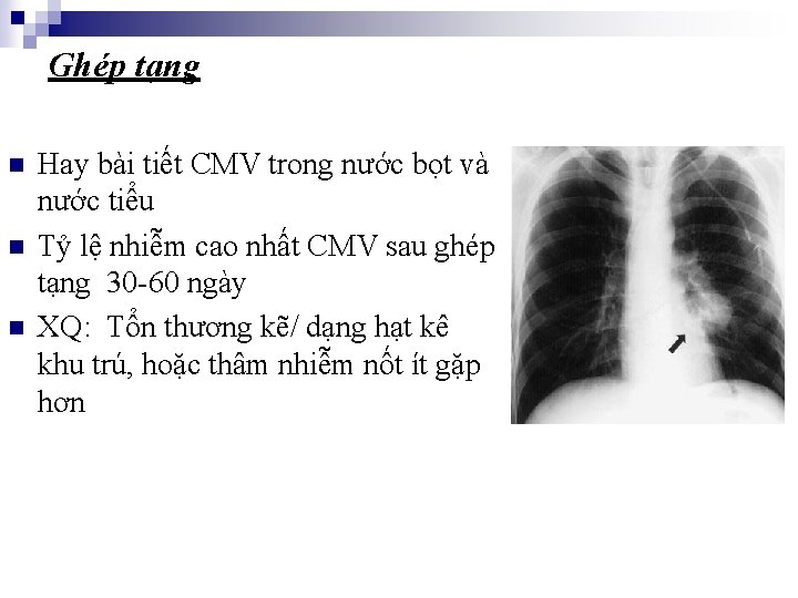 Ghép tạng n n n Hay bài tiết CMV trong nước bọt và nước