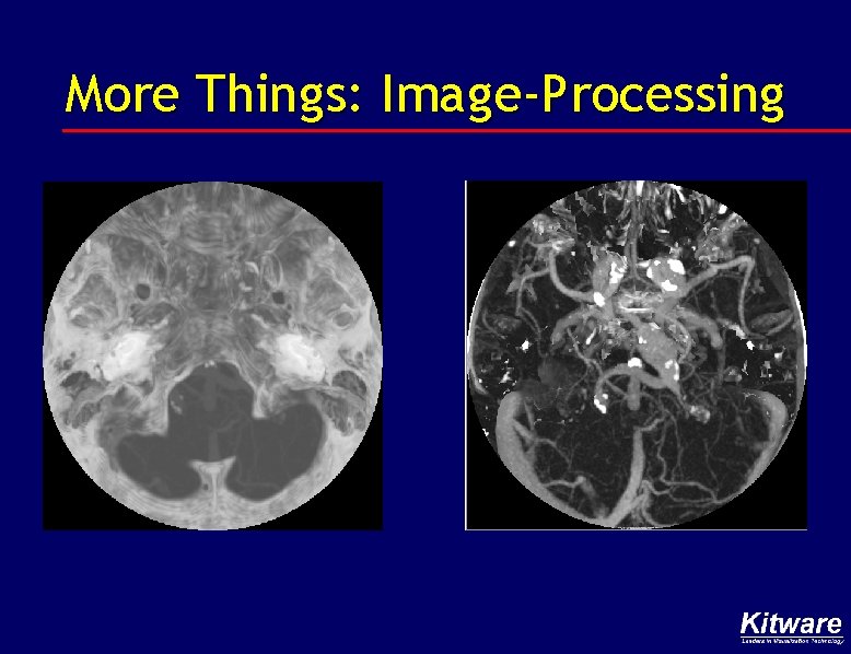 More Things: Image-Processing 