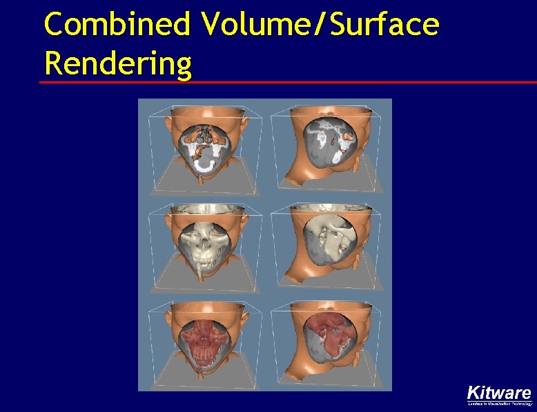 Combined Volume/Surface Rendering 