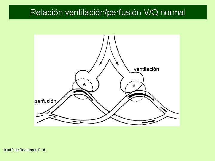 Relación ventilación/perfusión V/Q normal ventilación perfusión Modif. de Bevilacqua F. id. 