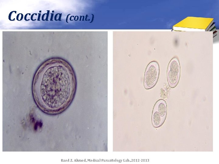 Coccidia (cont. ) Raed Z. Ahmed, Medical Parasitology Lab. , 2012 -2013 