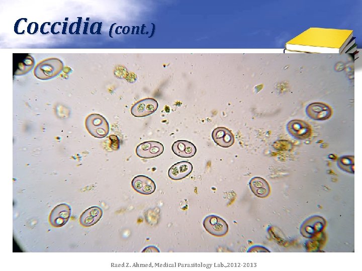 Coccidia (cont. ) Raed Z. Ahmed, Medical Parasitology Lab. , 2012 -2013 