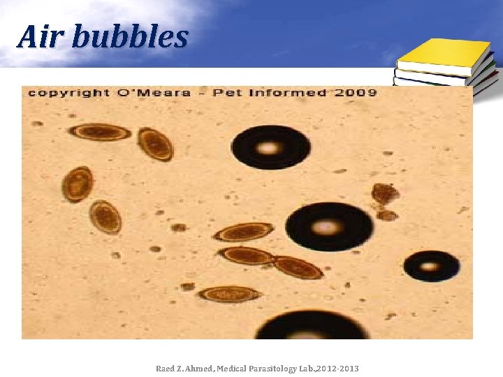 Air bubbles Raed Z. Ahmed, Medical Parasitology Lab. , 2012 -2013 