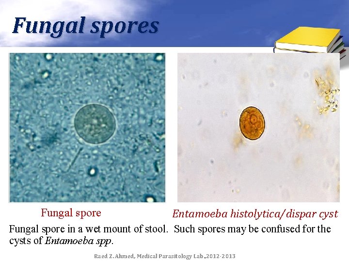 Fungal spores Fungal spore Entamoeba histolytica/dispar cyst Fungal spore in a wet mount of