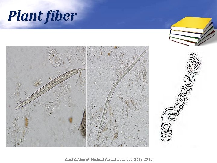 Plant fiber Raed Z. Ahmed, Medical Parasitology Lab. , 2012 -2013 