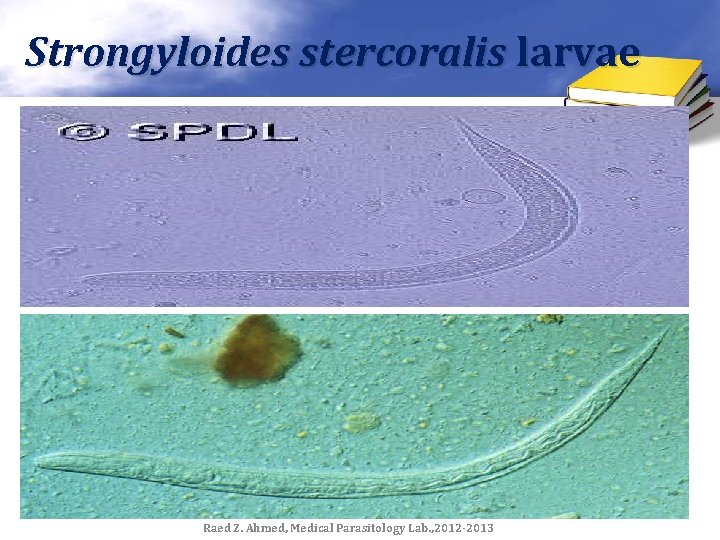 Strongyloides stercoralis larvae Raed Z. Ahmed, Medical Parasitology Lab. , 2012 -2013 