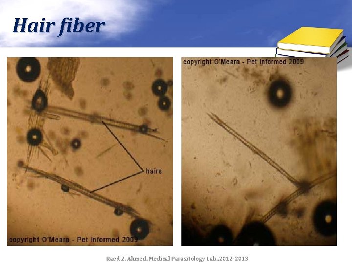 Hair fiber Raed Z. Ahmed, Medical Parasitology Lab. , 2012 -2013 