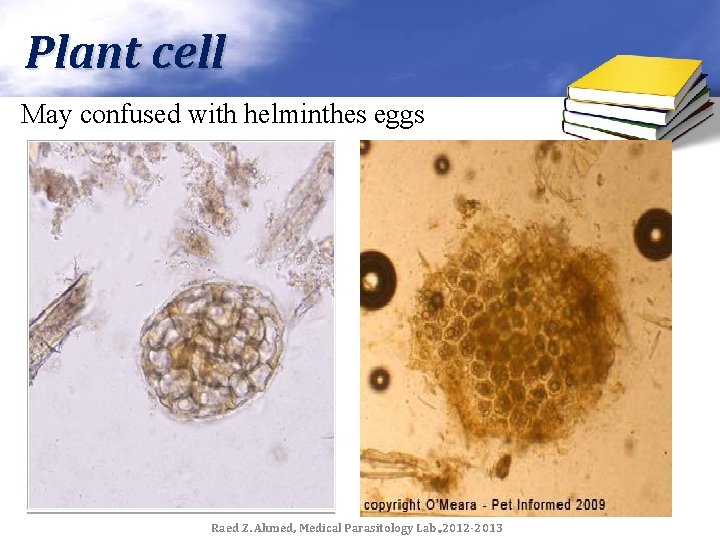 Plant cell May confused with helminthes eggs Raed Z. Ahmed, Medical Parasitology Lab. ,