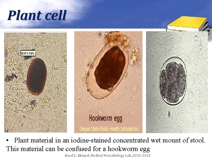 Plant cell • Plant material in an iodine-stained concentrated wet mount of stool. This