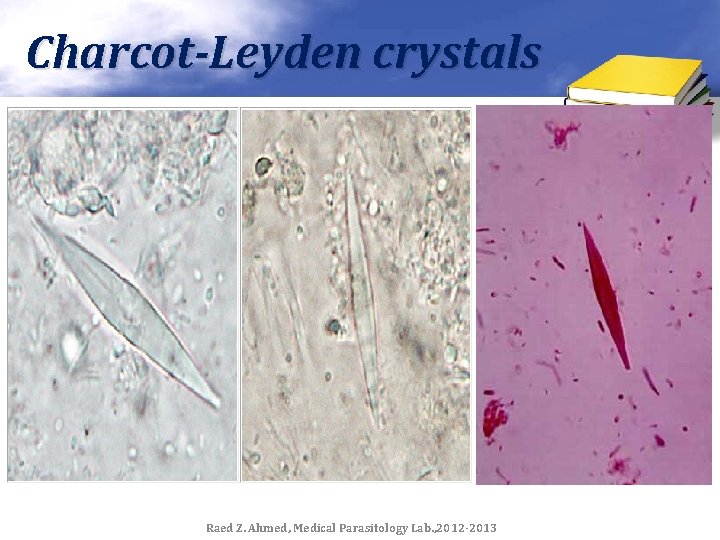 Charcot-Leyden crystals Raed Z. Ahmed, Medical Parasitology Lab. , 2012 -2013 