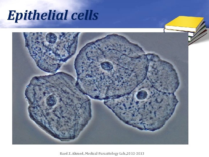 Epithelial cells Raed Z. Ahmed, Medical Parasitology Lab. , 2012 -2013 