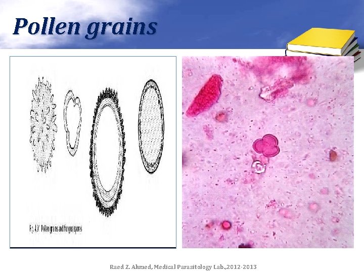 Pollen grains Raed Z. Ahmed, Medical Parasitology Lab. , 2012 -2013 