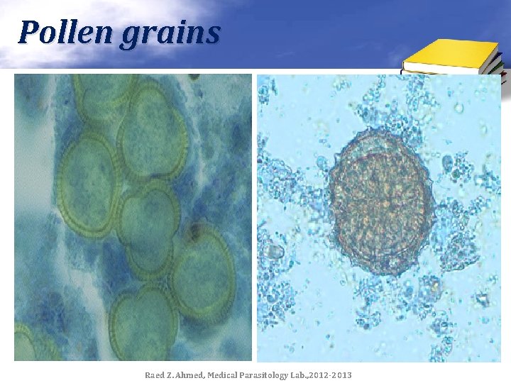 Pollen grains Raed Z. Ahmed, Medical Parasitology Lab. , 2012 -2013 