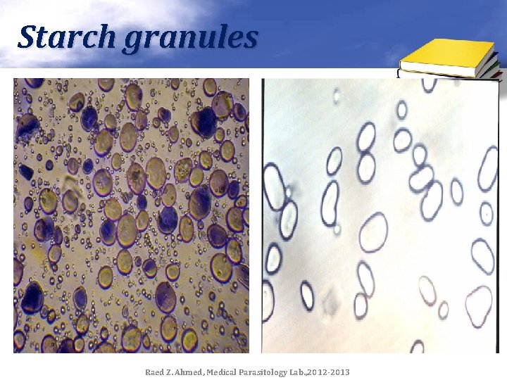 Starch granules Raed Z. Ahmed, Medical Parasitology Lab. , 2012 -2013 