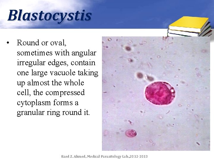Blastocystis • Round or oval, sometimes with angular irregular edges, contain one large vacuole