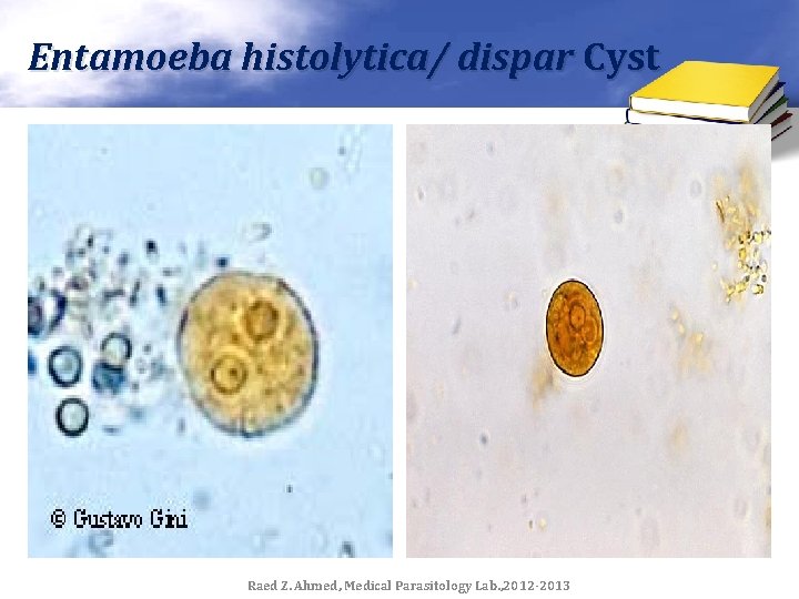 Entamoeba histolytica/ dispar Cyst Raed Z. Ahmed, Medical Parasitology Lab. , 2012 -2013 