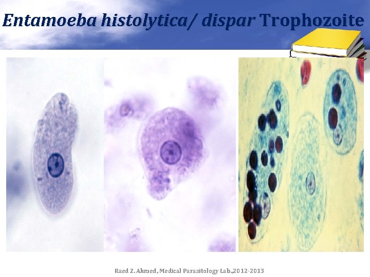Entamoeba histolytica/ dispar Trophozoite Raed Z. Ahmed, Medical Parasitology Lab. , 2012 -2013 