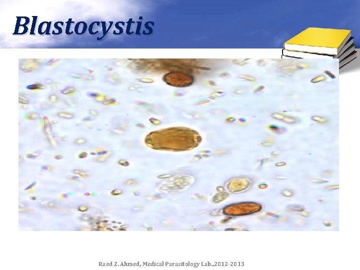 Blastocystis Raed Z. Ahmed, Medical Parasitology Lab. , 2012 -2013 