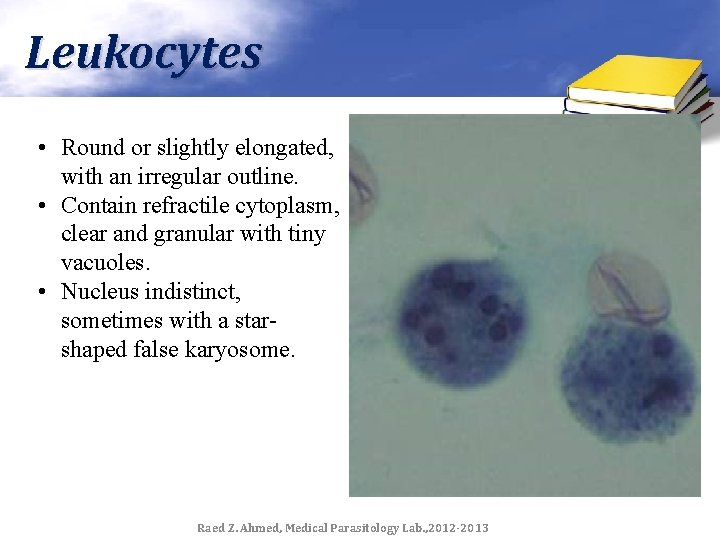 Leukocytes • Round or slightly elongated, with an irregular outline. • Contain refractile cytoplasm,