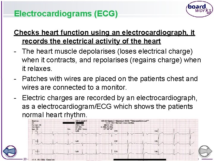 Electrocardiograms (ECG) Checks heart function using an electrocardiograph, it records the electrical activity of