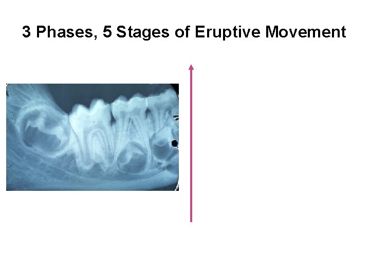 3 Phases, 5 Stages of Eruptive Movement 