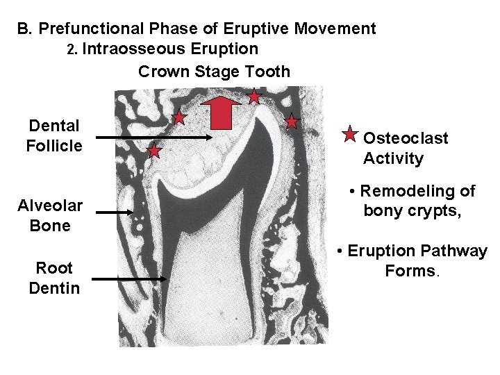 B. Prefunctional Phase of Eruptive Movement 2. Intraosseous Eruption Crown Stage Tooth Dental Follicle