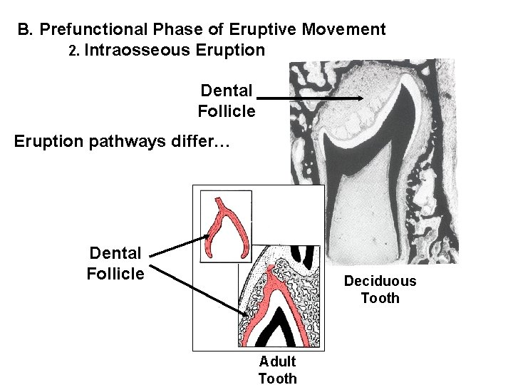 B. Prefunctional Phase of Eruptive Movement 2. Intraosseous Eruption Dental Follicle Eruption pathways differ…